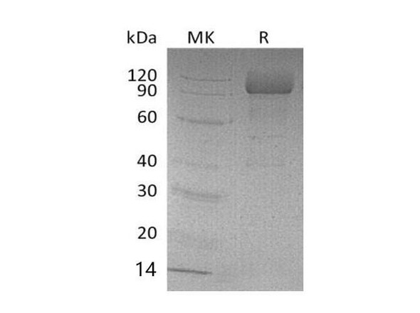 Mouse SCARB2/LIMPII Recombinant Protein (RPES2791)