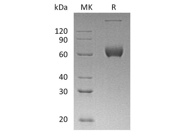 Human ESAM Recombinant Protein (RPES2806)