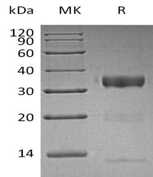 Human Kallikrein 10/KLK10 Recombinant Protein (RPES2807)