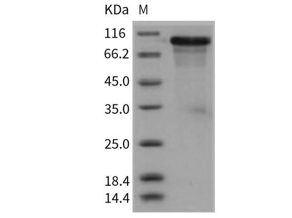 Mouse ECM1 Recombinant Protein (RPES2822)