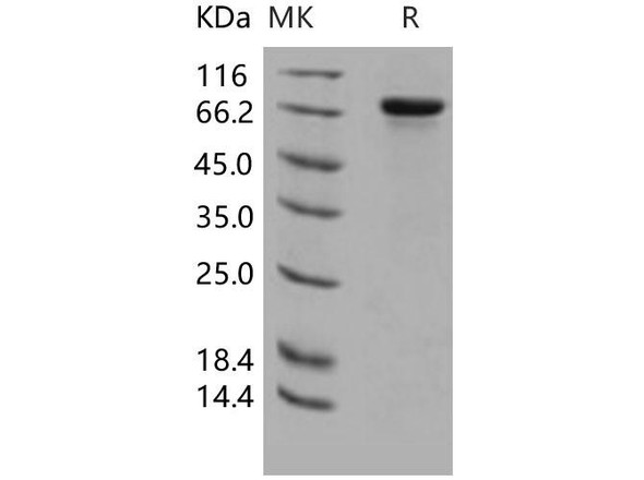 Human HPRG/HRG Recombinant Protein (RPES2824)