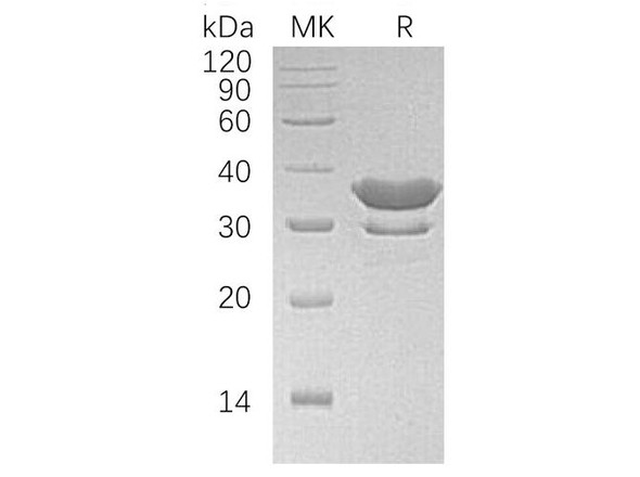 Human SULT2A1 Recombinant Protein (RPES2855)