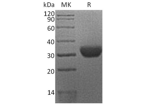Human Erythropoietin R/EPOR Recombinant Protein (RPES2856)