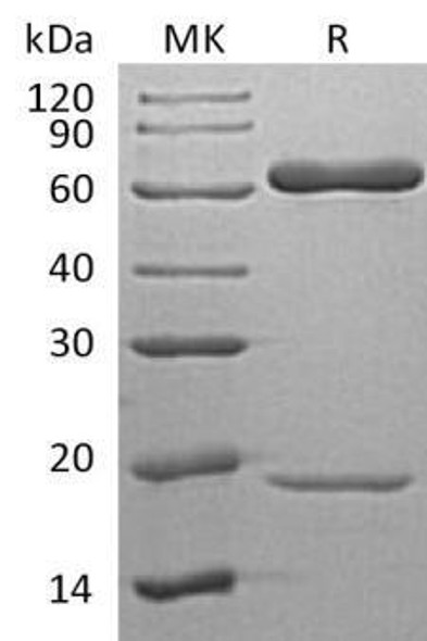 Human PCSK9 Recombinant Protein (RPES2870)