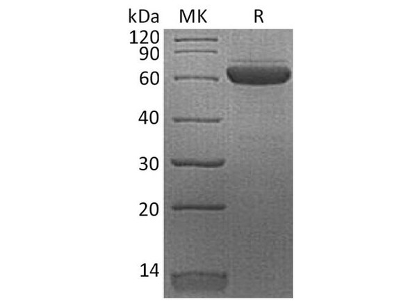 Human Erythropoietin R/EPOR Recombinant Protein (RPES2877)