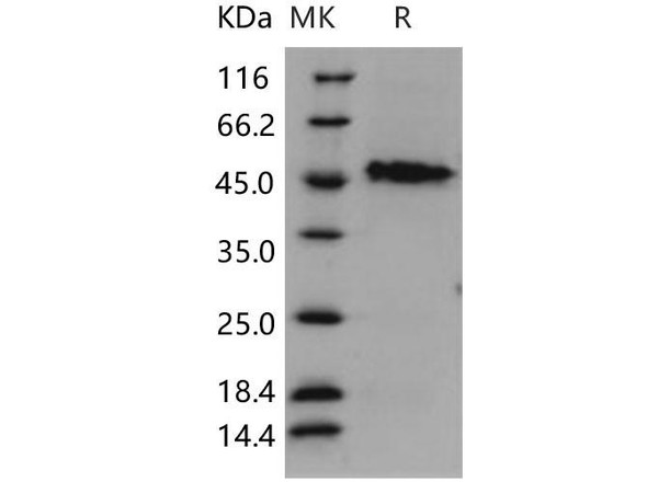 Human GAP43/Neuromodulin Recombinant Protein (RPES2880)