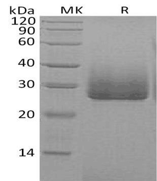 Human Apolipoprotein D/ApoD Recombinant Protein (RPES2888)
