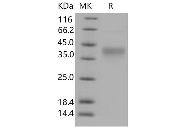 Human CD48 Recombinant Protein (RPES2908)