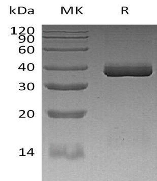 Human Apolipoprotein E/ApoE Recombinant Protein (RPES2909)