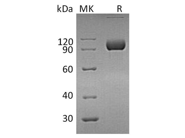 Human EphA4 Recombinant Protein (RPES2910)