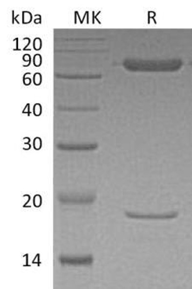Human PCSK9 Recombinant Protein (RPES2912)