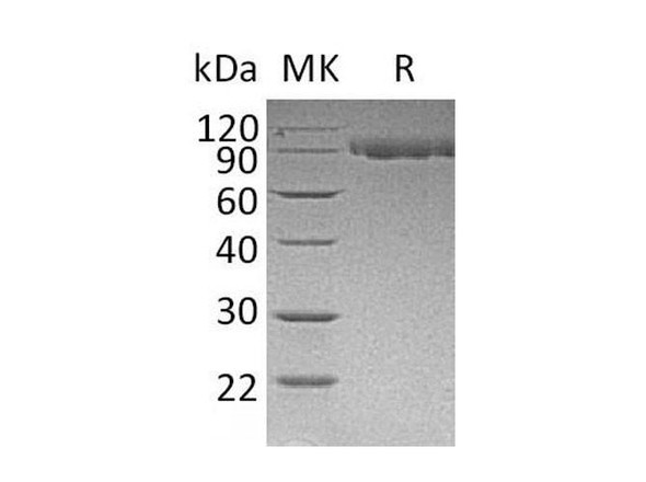 Mouse Serpin G1/C1IN Recombinant Protein (RPES2934)