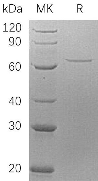Human AIFM1 Recombinant Protein (RPES2948)
