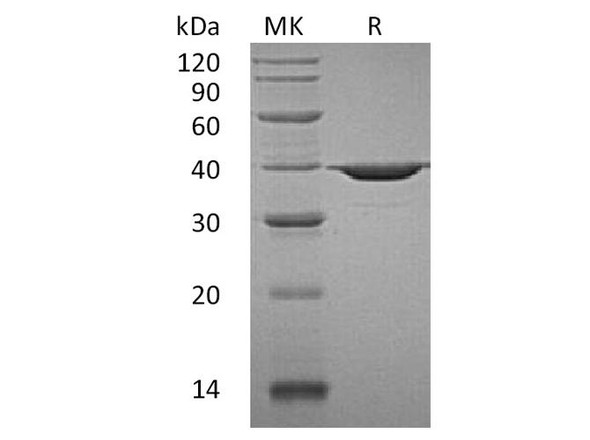 Human APE1/APE Recombinant Protein (RPES2965)