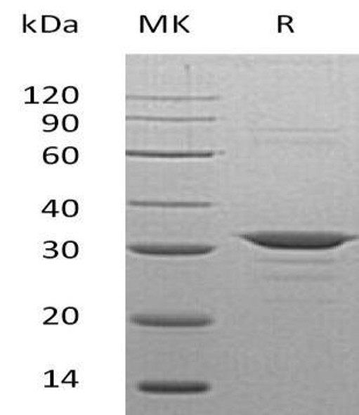 Human CLIC4 Recombinant Protein (RPES2978)