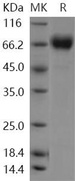 Human CD68/Macrosialin Recombinant Protein (RPES2997)