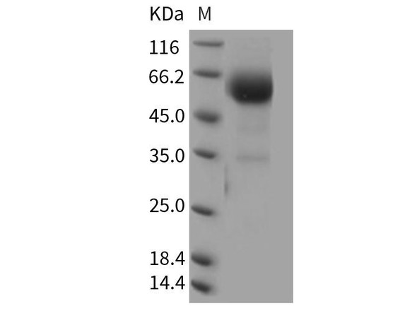 Mouse BTLA/CD272 Recombinant Protein (RPES2999)