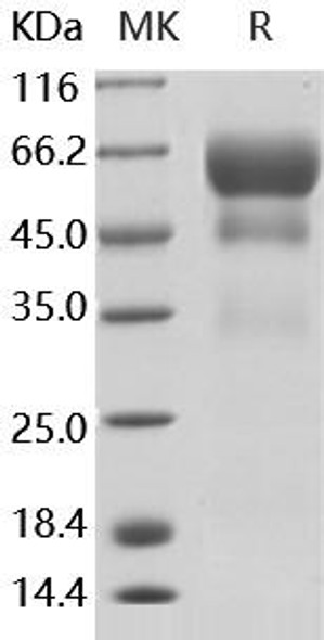 Human PSAP/Prosaposin Recombinant Protein (RPES3014)