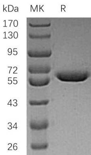 Human Arylsulfatase A/ARSA Recombinant Protein (RPES3022)