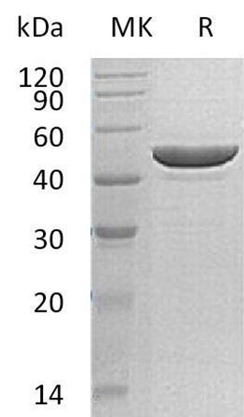 Human Protamine-2/PRM2 Recombinant Protein (RPES3025)