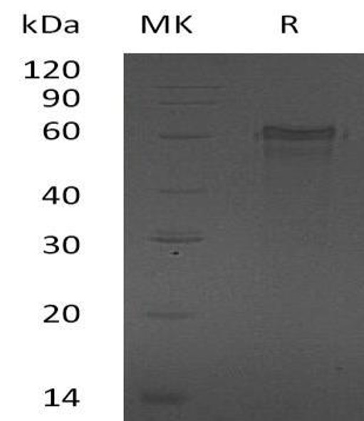 Human ZNF70 Recombinant Protein (RPES3026)