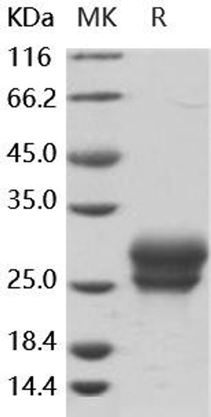 Human Frizzled-4/FZD4 Recombinant Protein (RPES3034)