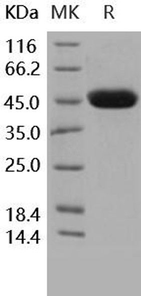 Carbonic Anhydrase 14/CA14 Recombinant Protein (RPES3037)
