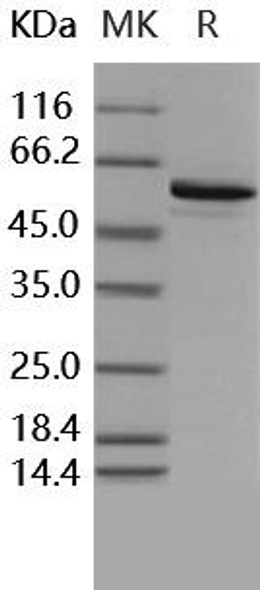Human BMPR1B/ALK-6 Recombinant Protein (RPES3041)