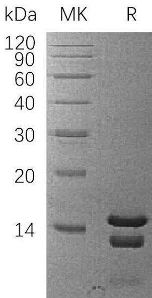 Human PEA15 Recombinant Protein (RPES3043)