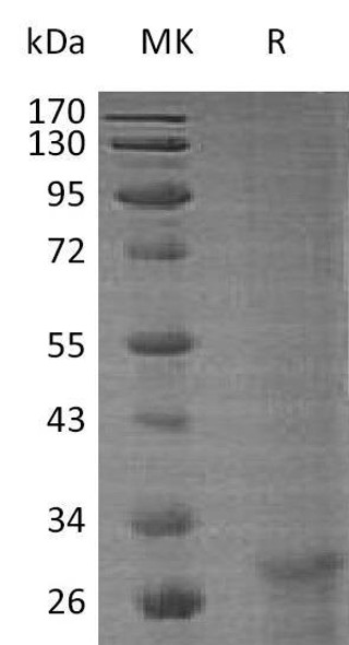 Human KLF6 Recombinant Protein (RPES3045)