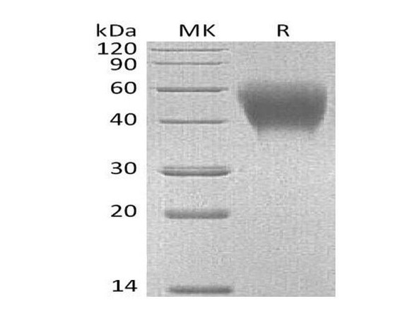 Mouse CD150/SLAM Recombinant Protein (RPES3048)