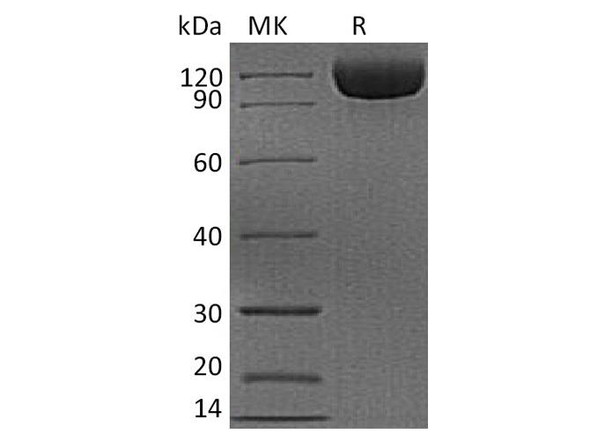 Human DPP4/DPPIV/CD26 Recombinant Protein (RPES3052)