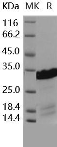 Human BCL2L1/Bcl-XL Recombinant Protein (RPES3057)
