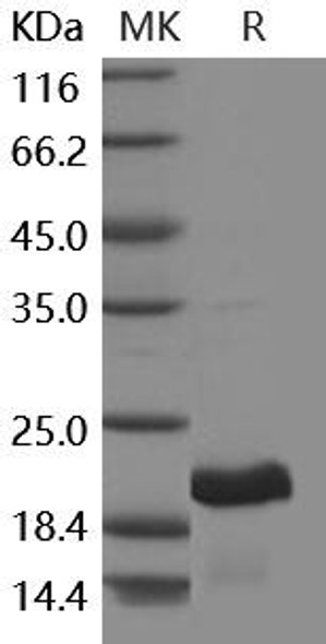 Human GH1/Growth hormone 1 Recombinant Protein  (RPES3115)