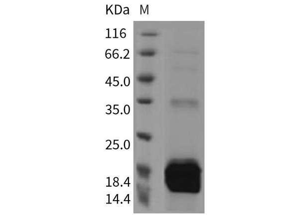 Mouse S100A9 Recombinant Protein (RPES3121)