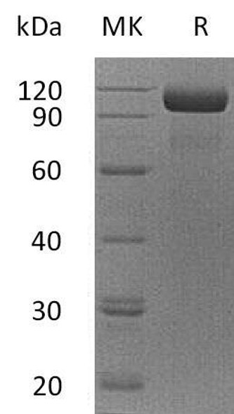 Human EGFR/ErbB1 Recombinant Protein (RPES3125)