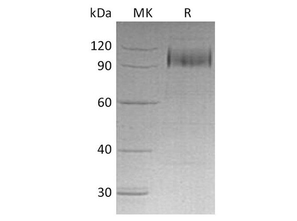 Human EGFR/ErbB1 Recombinant Protein (RPES3145)
