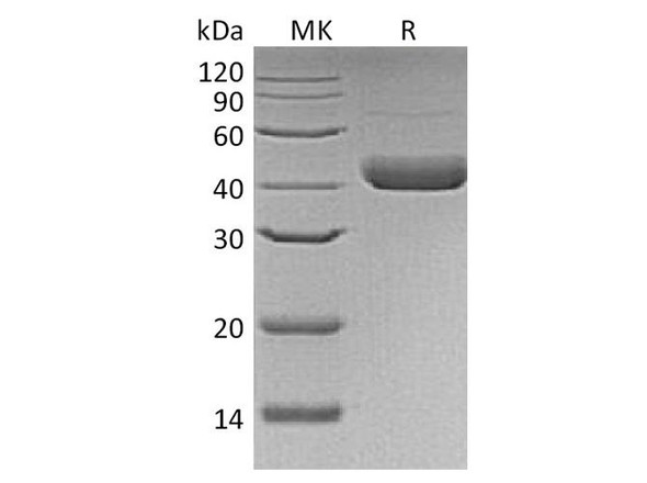 Human Decorin Recombinant Protein (RPES3173)