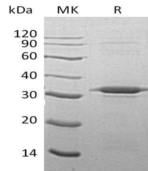 Human ATG5 Recombinant Protein (RPES3181)