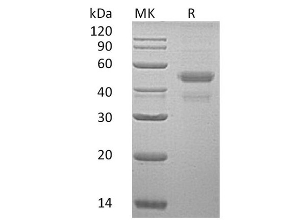 Human ERP44 Recombinant Protein (RPES3182)