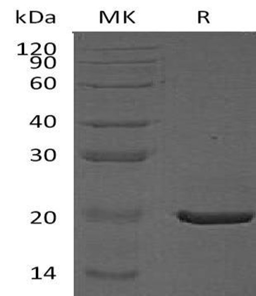Human CRYAA Recombinant Protein (RPES3185)