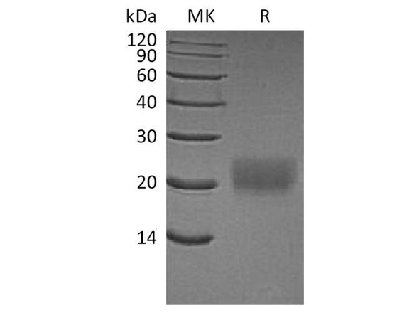 Human CTLA4 Recombinant Protein (RPES3191)