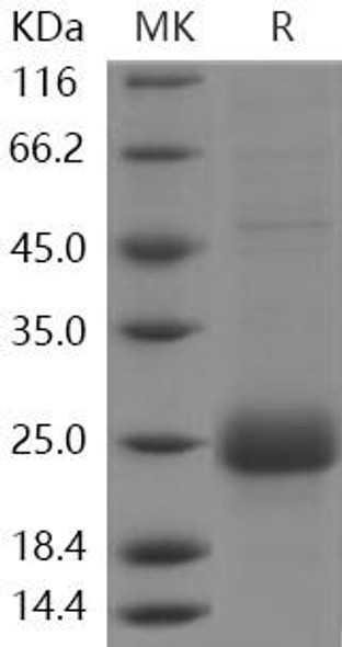 Human CTLA4/CD152 Recombinant Protein (RPES3194)