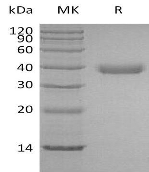 Human Azurocidin/CAP37 Recombinant Protein (RPES3200)