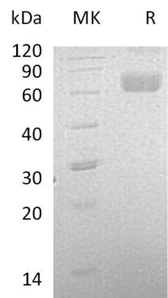 Human LCAT Recombinant Protein (RPES3202)