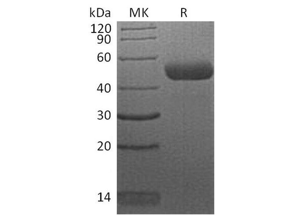 Human CTLA4 Recombinant Protein (RPES3210)