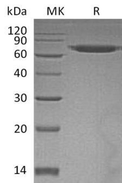 Human ERO1A/ERO1L Recombinant Protein (RPES3221)