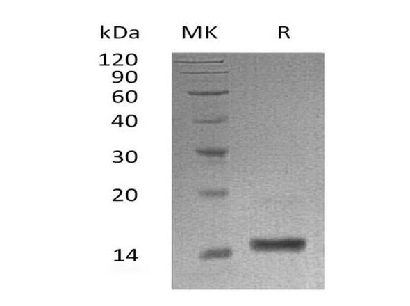 Human B-Lactalbumin/LALBA Recombinant Protein (RPES3224)