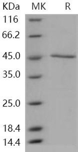 Human GADD45A/DDIT Recombinant Protein (RPES3234)