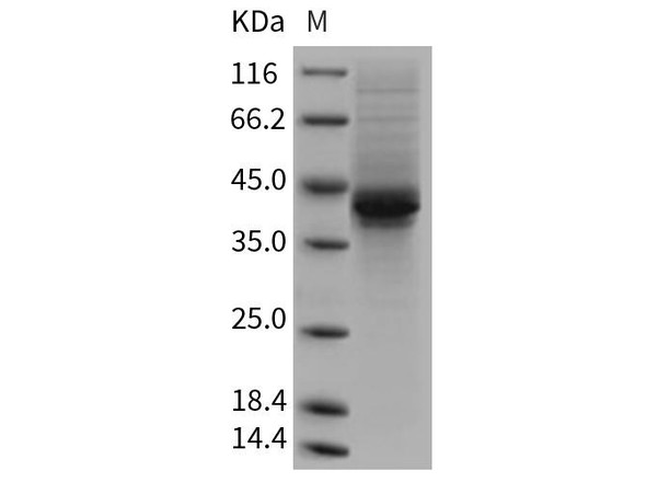 Mouse AgRP/AGRP Recombinant Protein (RPES3238)